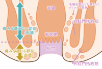 肛門ボトックス